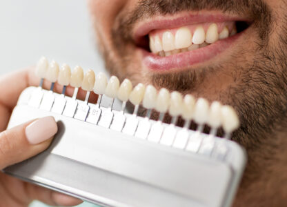 The Dental Veneers Survival Guide