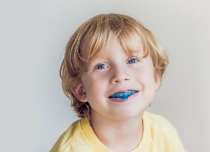 5 Interesting Facts About Sports Mouth Guard