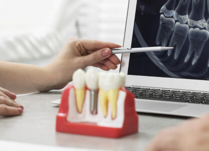 What Is Expected From A Dental Implant Consultation?