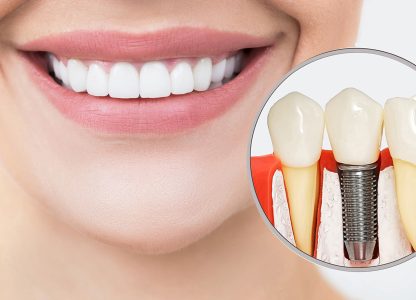 Understanding Bone Density and Its Effect on Dental Implants